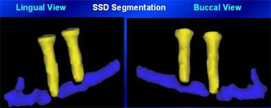 2004 11 15 17 43 06 706