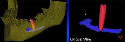 2004 11 15 17 43 25 706