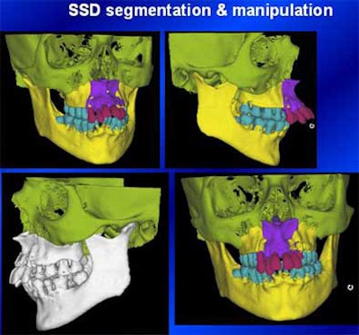 2004 11 15 17 45 17 706