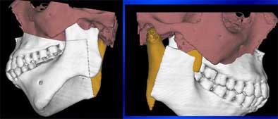 2004 11 15 17 45 32 706