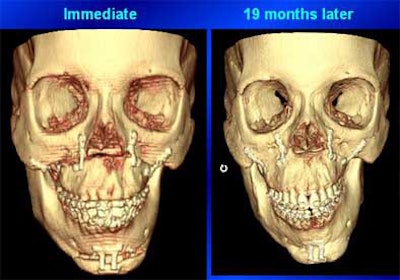 2004 11 15 17 45 47 706