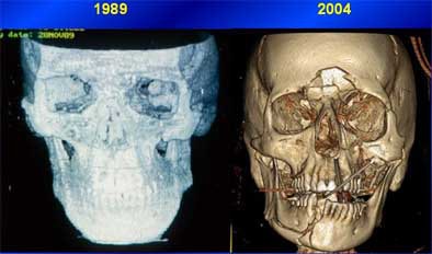 2004 11 15 17 46 27 706