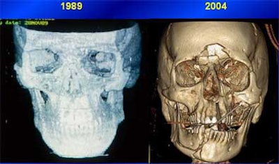 2004 11 15 17 46 27 706