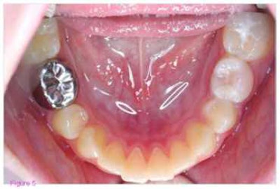 2008 01 03 11 55 01 706