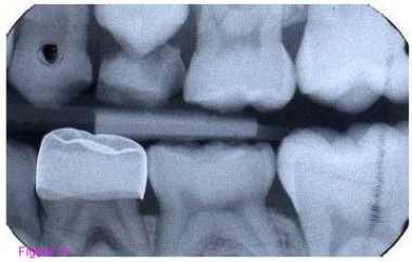 2008 01 03 11 55 16 706