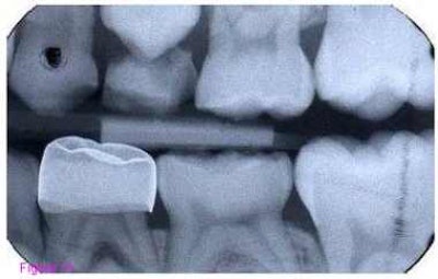 2008 01 03 11 55 16 706