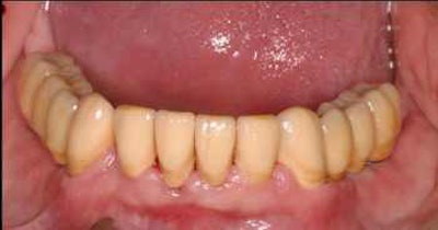 2008 01 07 13 31 31 706