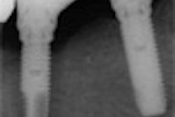 2008 01 07 15 23 52 706