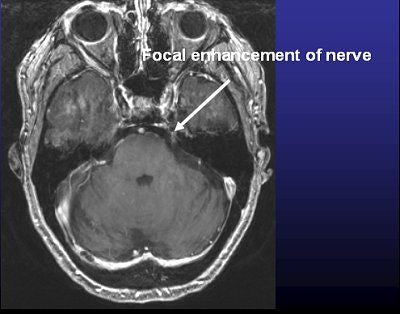 2008 01 22 17 18 31 706