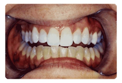 2008 03 12 10 30 16 706