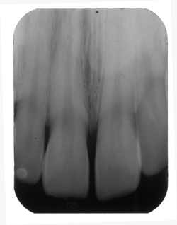 2008 03 28 16 41 43 706