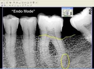 2008 04 01 14 47 00 706