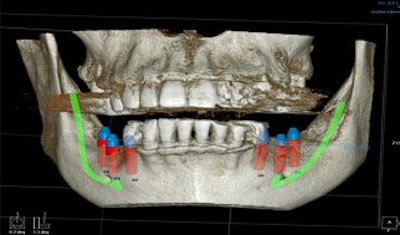 2008 04 29 15 59 12 706