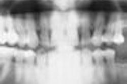 2008 06 04 16 27 28 472 Pan Thumb 2008 06 05