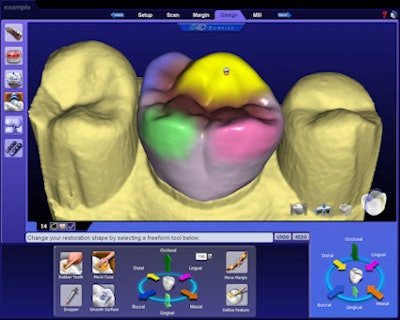 Like the Cerec, the E4D allows operators to design a crown in three dimensions on its screen.