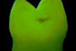 2008 06 25 13 43 47 365 Ql Fglowing Thumb