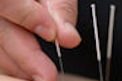 2008 07 03 09 39 44 191 Acupuncture 90