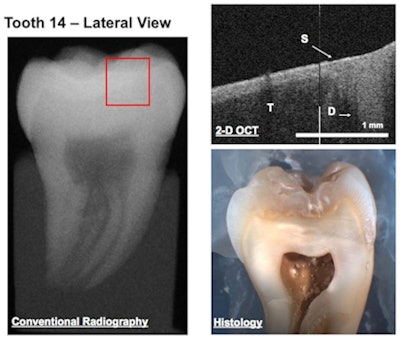 2008 07 09 09 16 15 267 2008 07 11 Oct3d