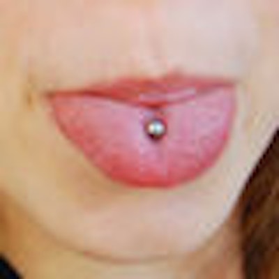 2008 07 11 15 18 00 338 Tongue Piercing 80