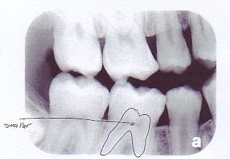 2008 08 19 11 53 51 325 2008 08 19 Age 16bw