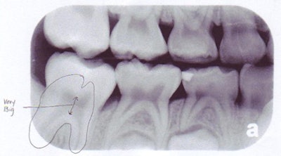 2008 08 19 11 53 56 207 2008 08 19 Age 9bw