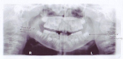 2008 08 19 12 01 55 448 2008 08 19 Age 9pano2