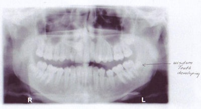 2008 08 19 12 01 56 550 2008 08 19 Age 16pano2