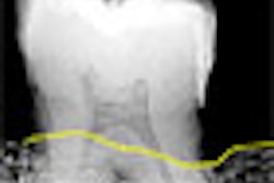2008 10 02 17 02 55 979 Caries Detection
