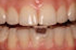 2008 11 05 11 09 44 508 2008 11 05 Nti Thumb