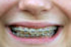 2008 12 05 15 46 27 330 Orthodontics 70