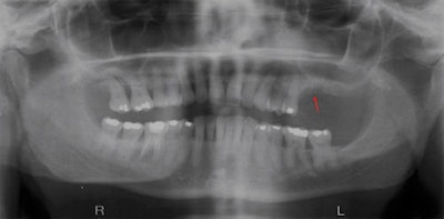 2009 01 09 15 46 46 646 2009 01 16 Bonj Pano