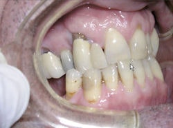 2009 01 26 12 59 34 207 2009 01 26 Image2