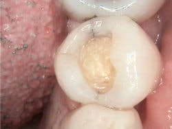 2009 01 26 12 59 34 528 2009 01 26 Image1