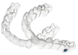 2009 01 30 11 57 57 69 2009 01 29 Invisalign