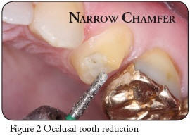 2009 02 06 16 34 33 401 Dental Advisor Fig 2