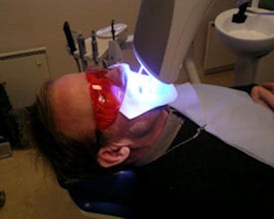 2009 02 18 16 17 36 453 2009 02 19 U Vbleaching