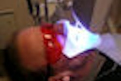 2009 02 18 16 17 36 470 2009 02 19 U Vbleaching Thumb