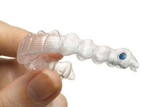 2009 02 20 11 05 52 860 2009 02 20 Invisalign