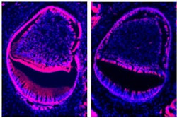 2009 02 25 10 47 45 895 2009 02 25 Enamel Gene