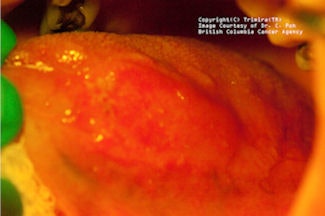 2009 03 03 17 23 20 113 2009 03 04 Identafi Amber2