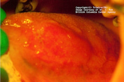 2009 03 03 17 23 20 113 2009 03 04 Identafi Amber2