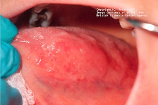 2009 03 03 17 23 21 332 2009 03 04 Identafi White2