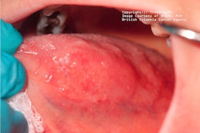 2009 03 03 17 23 21 332 2009 03 04 Identafi White2