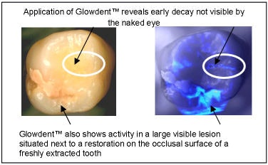 2009 03 17 09 11 53 68 2009 03 12 Luxds