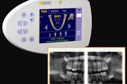 2009 03 17 10 51 51 708 2009 03 16 Sirona Bitewings