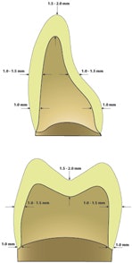 2009 03 17 15 01 38 840 Cad Cam Teeth Sm