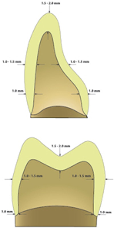 2009 03 17 15 01 38 840 Cad Cam Teeth Sm