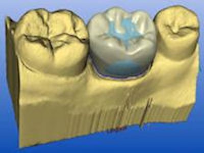 2009 03 30 15 02 02 734 2009 03 31 Cadcam2c