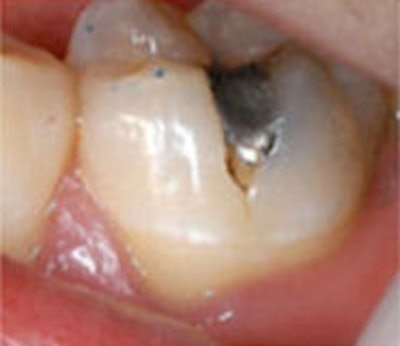 2009 04 07 10 26 28 427 2009 04 07 Prepb