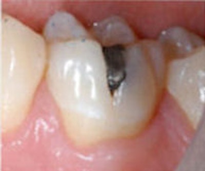 2009 04 07 10 26 28 640 2009 04 07 Baselineb